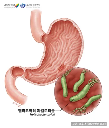 헬리코박터 파일로리균