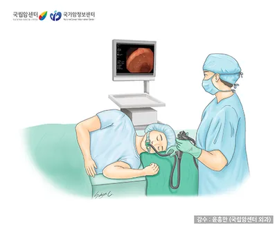 위내시경 검사